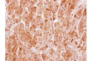 IHC-P Image Immunohistochemical analysis of paraffin-embedded MCF7 xenograft, using MVD, antibody at 1:100 dilution.
