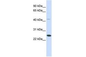 FAM119A anticorps  (AA 72-121)