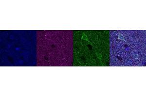 Immunohistochemistry (IHC) image for anti-Ubiquitin Carboxyl-terminal Esterase L1 (Ubiquitin Thiolesterase) (UCHL1) antibody (ABIN7456167) (UCHL1 anticorps)