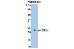 Western Blotting (WB) image for anti-Keratin 7 (KRT7) (AA 255-393) antibody (ABIN1859582) (Cytokeratin 7 anticorps  (AA 255-393))