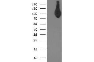 Western Blotting (WB) image for anti-Activating Signal Cointegrator 1 Complex Subunit 2 (ASCC2) antibody (ABIN1496740) (ASCC2 anticorps)