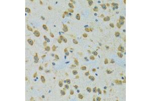 Immunohistochemistry of paraffin-embedded rat brain using RPS7 antibody.