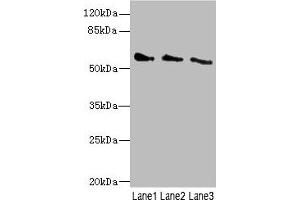 Western blot All lanes: CHRNG antibody at 5. (CHRNG anticorps  (AA 328-517))
