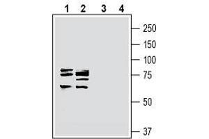 Cortactin (CTTN) peptide