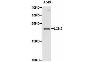 Western blot analysis of extracts of A-549 cells, using LCN2 antibody (ABIN5998120) at 1/1000 dilution. (Lipocalin 2 anticorps)