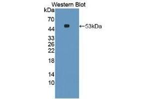Detection of Recombinant IL6, Rabbit using Monoclonal Antibody to Interleukin 6 (IL6)