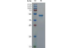 Human F Protein, hFc Tag on SDS-PAGE under reducing condition.