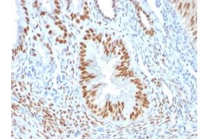 Formalin-fixed, paraffin-embedded human Endometrium stained with Estrogen Receptor alpha Mouse Monoclonal Antibody (ER506). (Estrogen Receptor alpha anticorps  (AA 2-185))