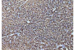 IHC analysis of ADH1A using anti-ADH1A antibody (ABIN4886427). (ADH1A anticorps  (AA 213-375))