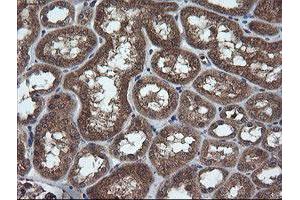 anti-Tripartite Motif Containing 44 (TRIM44) antibody