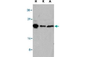 Western blot analysis of NOL3 in HeLa (H), KB (K), and A-549 (A) whole cell lysates with NOL3 polyclonal antibody  at 1 : 1000 dilution. (NOL3 anticorps  (AA 191-208))