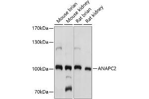 Western blot analysis of extracts of various cell lines, using  antibody (ABIN7265581) at 1:1000 dilution. (ANAPC2 anticorps  (AA 400-500))