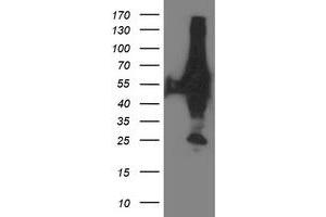 Western Blotting (WB) image for anti-X-Prolyl Aminopeptidase (Aminopeptidase P) 3, Putative (XPNPEP3) antibody (ABIN1501766)