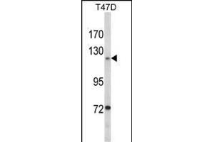 Western blot analysis of PTK2 Antibody (Center) (ABIN1882121 and ABIN2842373) in T47D cell line lysates (35 μg/lane). (FAK anticorps  (AA 396-423))