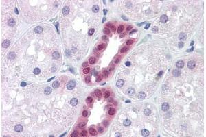 Human Kidney: Formalin-Fixed, Paraffin-Embedded (FFPE)