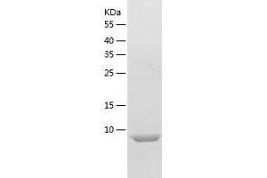 Western Blotting (WB) image for Osteocalcin (BGLAP) (AA 50-99) protein (His-IF2DI Tag) (ABIN7124278)