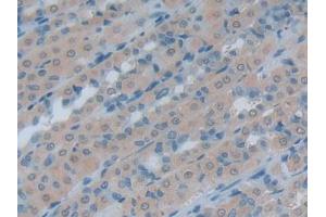 IHC-P analysis of Rat Intestine Tissue, with DAB staining. (HSPH1 anticorps  (AA 595-733))