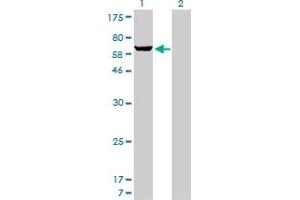 Western Blot analysis of PAPSS1 expression in transfected 293T cell line by PAPSS1 monoclonal antibody (M05), clone 1F4. (PAPSS1 anticorps  (AA 144-252))