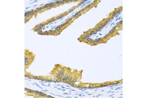 Immunohistochemistry of paraffin-embedded human prostate using BTD antibody (ABIN5973709) at dilution of 1/100 (40x lens). (BTD anticorps)