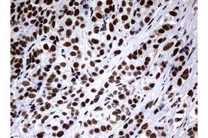 Image no. 10 for anti-Nibrin (NBN) (AA 183-460) antibody (ABIN1491059)