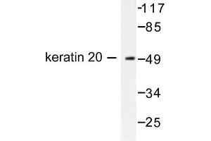 Image no. 1 for anti-Keratin 20 (KRT20) antibody (ABIN265500) (KRT20 anticorps)