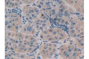 Detection of DEFb1 in Rat Liver cancer Tissue using Polyclonal Antibody to Defensin Beta 1 (DEFb1)