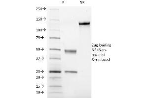 SDS-PAGE Analysis Purified CD41a Mouse Monoclonal Antibody (ITGA2B/1036). (Integrin Alpha2b anticorps)