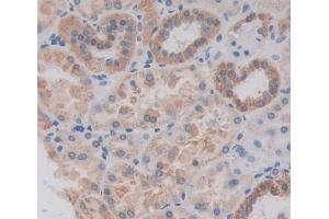 Used in DAB staining on fromalin fixed paraffin- embedded kidney tissue (PEX1 anticorps  (AA 62-219))