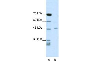 WB Suggested Anti-CACNB4 Antibody Titration:  0. (CACNB4 anticorps  (C-Term))