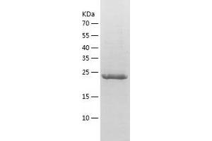 Western Blotting (WB) image for Thymocyte Nuclear Protein 1 (THYN1) (AA 1-225) protein (His-IF2DI Tag) (ABIN7125386)