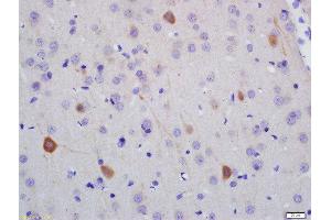 Formalin-fixed and paraffin embedded rat brain labeled with Anti-NF-H Polyclonal Antibody, Unconjugated  at 1:200 followed by conjugation to the secondary antibody and DAB staining (NEFH anticorps  (AA 21-120))
