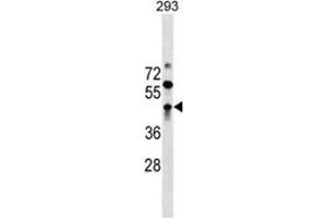 ZBTB32 Antibody (N-term) western blot analysis in 293 cell line lysates (35 µg/lane). (ZBTB32 anticorps  (N-Term))
