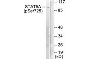Western blot analysis of extracts from Jurkat cells treated with EGF 200ng/ml 30', using STAT5A/B (Phospho-Ser725/730) Antibody. (STAT5 A/B anticorps  (pSer726))