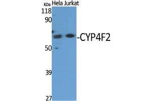 Western Blotting (WB) image for anti-Cytochrome P450, Family 4, Subfamily F, Polypeptide 2 (CYP4F2) (N-Term) antibody (ABIN3184201) (CYP4F2 anticorps  (N-Term))