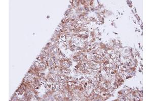 IHC-P Image Immunohistochemical analysis of paraffin-embedded DU145 xenograft, using GIRK1, antibody at 1:100 dilution.