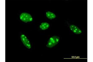 Immunofluorescence of purified MaxPab antibody to TSPYL1 on HeLa cell. (TSPYL1 anticorps  (AA 1-438))