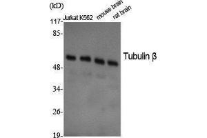Western Blotting (WB) image for anti-Tubulin, beta (TUBB) (C-Term) antibody (ABIN3187378) (TUBB anticorps  (C-Term))
