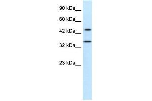 WB Suggested Anti-PNMA1 Antibody Titration:  0. (PNMA1 anticorps  (Middle Region))