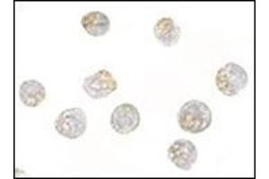 Immunocytochemistry of NUP107 in A549 cells with this product at 2.