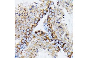Immunohistochemistry of paraffin-embedded mouse testis using γ-Tubulin Rabbit mAb (ABIN7271052) at dilution of 1:100 (40x lens).