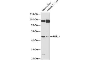 Western blot analysis of extracts of various cell lines, using RNF13 antibody (ABIN6128641, ABIN6147009, ABIN6147010 and ABIN6224394) at 1:1000 dilution. (RNF13 anticorps  (AA 204-381))