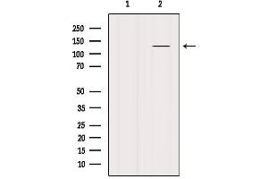 Western blot analysis of extracts from Mouse lung, using SMC3 Antibody. (SMC3 anticorps  (C-Term))