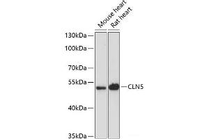 Western blot analysis of extracts of various cell lines using CLN5 Polyclonal Antibody at dilution of 1:3000. (CLN5 anticorps)