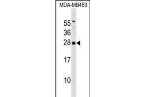 IT Antibody (C-term) (ABIN1536735 and ABIN2850350) western blot analysis in MDA-M cell line lysates (35 μg/lane). (ITPA anticorps  (C-Term))
