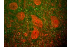 Rat spinal cord stained with anti-UCHL1(red) and anti-neurofilament NF-H antibody (1451-NFH)(green). (UCHL1 anticorps)