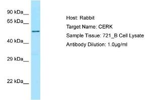 Host: Rabbit Target Name: CERK Sample Type: 721_B Whole Cell lysates Antibody Dilution: 1. (CERK anticorps  (C-Term))