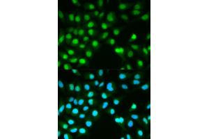 Immunofluorescence analysis of HeLa cells using PPP3CA antibody (ABIN5970422). (PPP3CA anticorps)