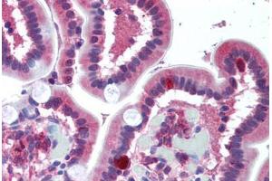 Human Small Intestine (formalin-fixed, paraffin-embedded) stained with FPR1 antibody ABIN297066 at 10 ug/ml followed by biotinylated goat anti-rabbit IgG secondary antibody ABIN481713, alkaline phosphatase-streptavidin and chromogen. (FPR1 anticorps  (AA 176-190))
