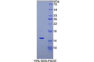 SDS-PAGE (SDS) image for Defensin, alpha 5, Paneth Cell-Specific (DEFA5) (AA 20-94) protein (His tag) (ABIN1170303)