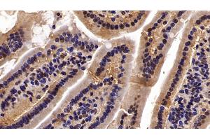 Detection of CBX3 in Mouse Small intestine Tissue using Polyclonal Antibody to Chromobox Homolog 3 (CBX3)